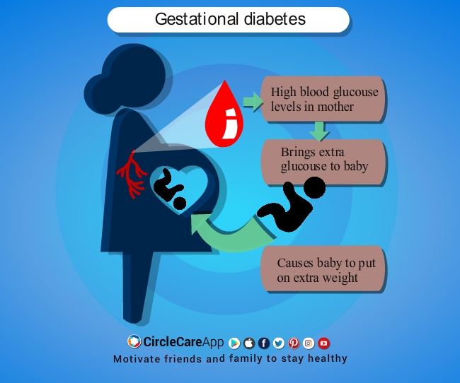 Gestational diabetes: What is it? Does  <a href=