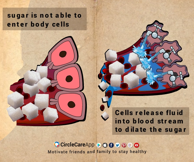 CircleCare-Type-2-diabetes-the-most-common-form-of-diabetes