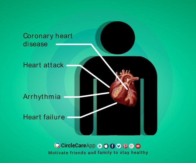 Diabetes Complications Longterm Risks Diabetes Complications Longterm Risks