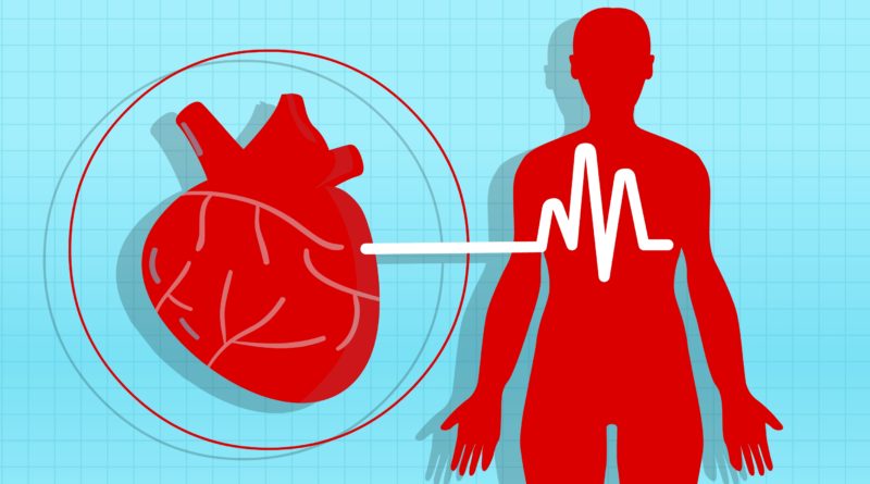 Hypertension-High-Blood-Pressure