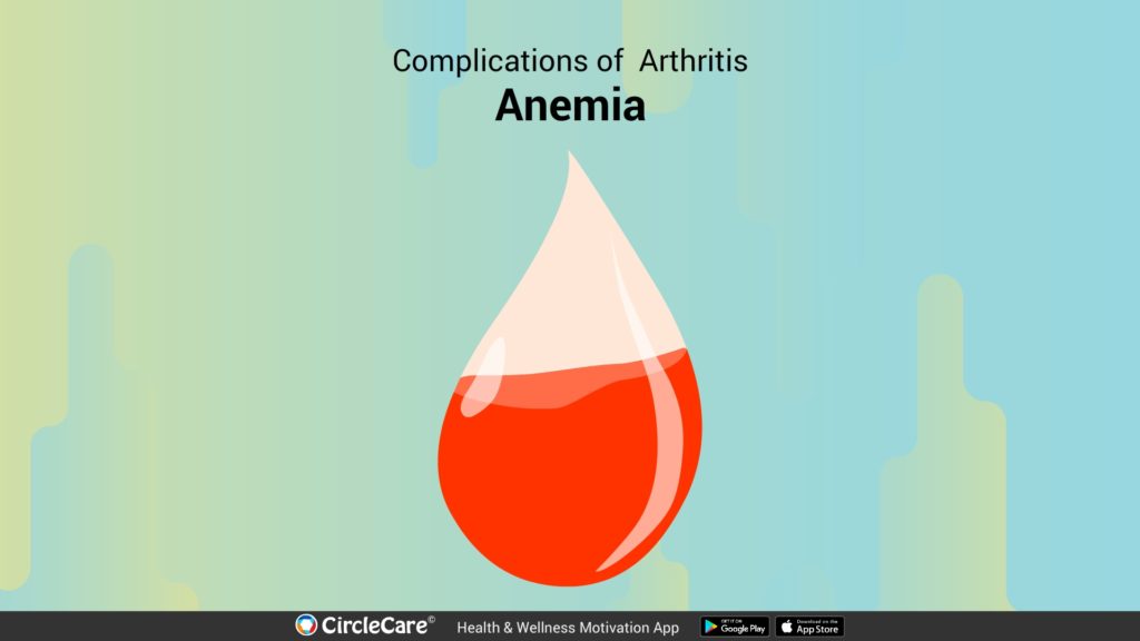 anemia-complications-caused-by-arthritis-circle-care-app