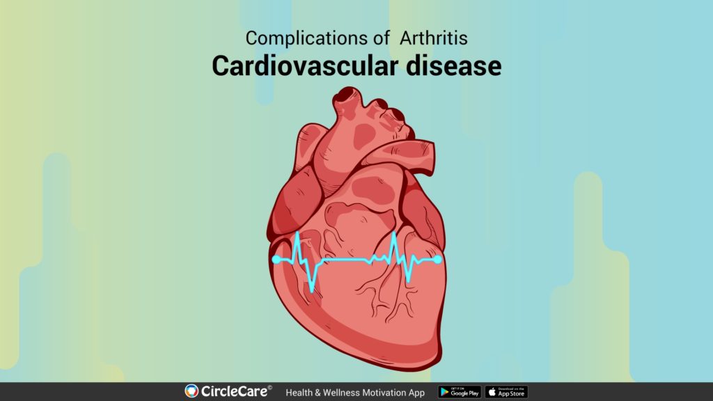 cardiovascular-disease-complications-caused-by-arthritis-circlecare