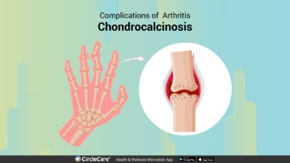 What are the complications caused by Arthritis? | CircleCare