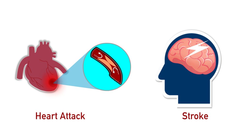 hypertension-risk-of-Heart Attack-Stroke-CircleCare