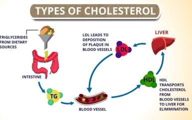 Types of Cholesterol: HDL, LDL and Triglycerides