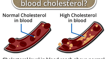 What-is-high-blood-cholesterol-circlecare