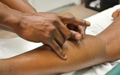 Understanding the Role & Benefits of Dry Needling