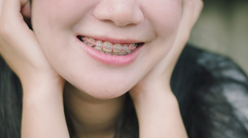 invisalign-can-benefit-comparison-treatments