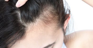 How is Hair Loss in Women Different than in Men