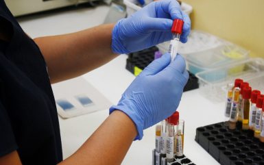 How Your Blood Test Will Be Kept and Treated