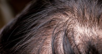 4 Ways to Hide Thinning Hair