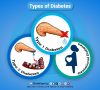 Types-of-diabetes