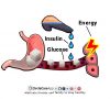 What-happens-to-your-body-when-you-have-diabetes