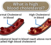 What-is-high-blood-cholesterol-circlecare